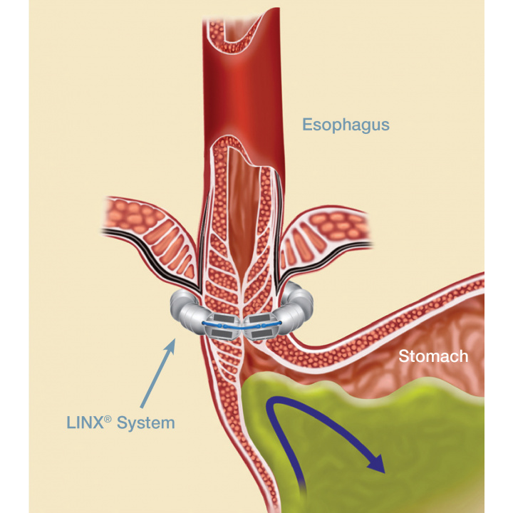 Amir Aryaie, MD, FACS Bariatric, General and Endoscopic Surgeon | 1105 Upper Hembree Rd suit A, Roswell, GA 30076, USA | Phone: (678) 626-0909