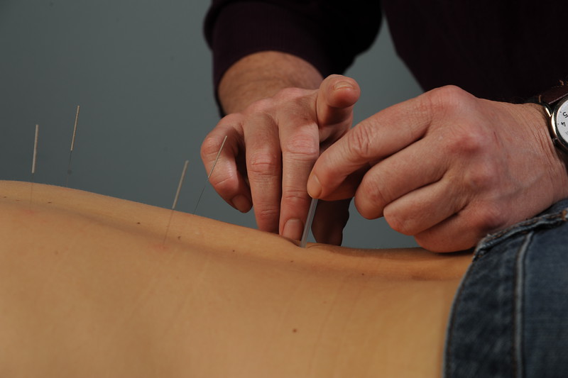 Acupuncture @ Inner Courtyard | 4820 A, 4820 Country Ct, Ellicott City, MD 21042 | Phone: (410) 491-6206