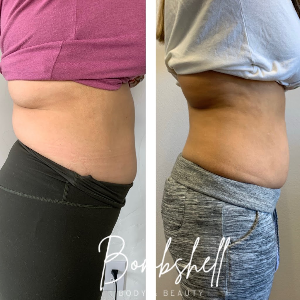 Bombshell Body & Beauty | 24619 Washington Ave, Murrieta, CA 92562, USA | Phone: (951) 797-7369