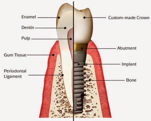 One Stop Implants | 14306 Victory Blvd, Van Nuys, CA 91401, USA | Phone: (818) 786-6000