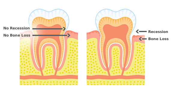 Southern Arizona Periodontics, P.L.C. | 403 W Cool Dr. Suite 101, Tucson, AZ 85704 | Phone: (520) 322-9300