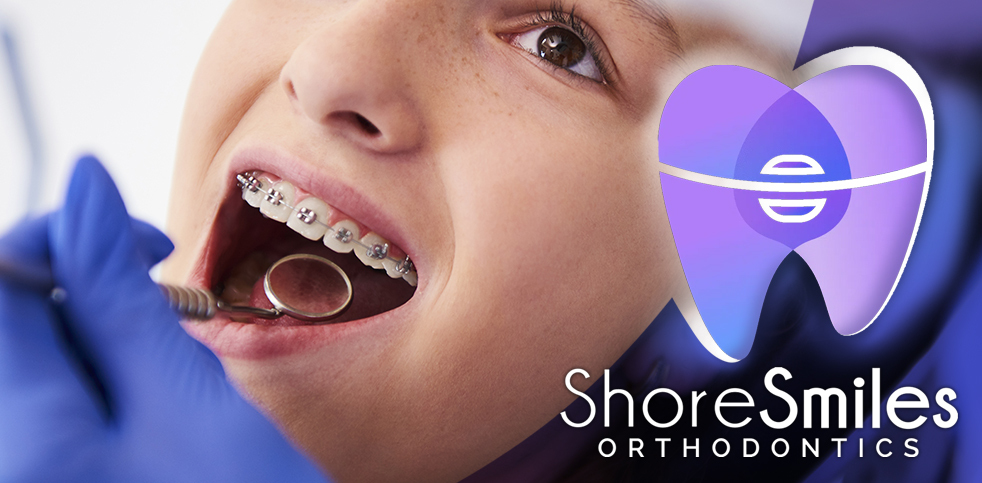 ShoreSmiles Orthodontics | 18550 Firlands Way N #300, Shoreline, WA 98133, USA | Phone: (206) 542-6188