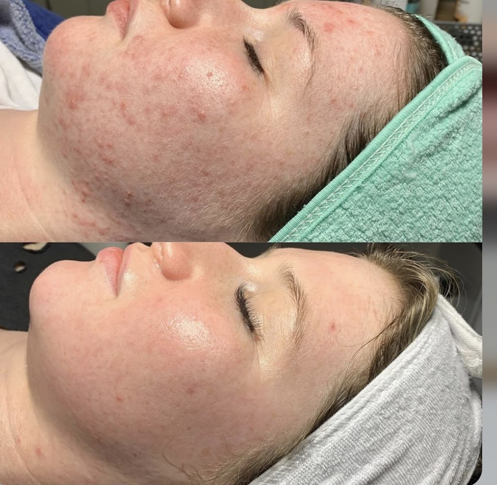 Revive Skin Bar | 1228 S Sossaman Rd #104, Mesa, AZ 85209, USA | Phone: (480) 660-7357