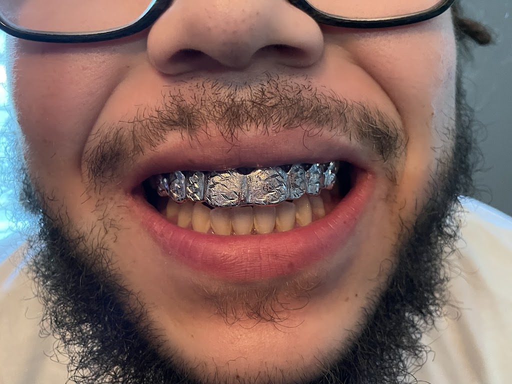 Mesa Gold Grillz LLC | 2105 S 48th St Suite 109, Tempe, AZ 85282, USA | Phone: (855) 290-4653