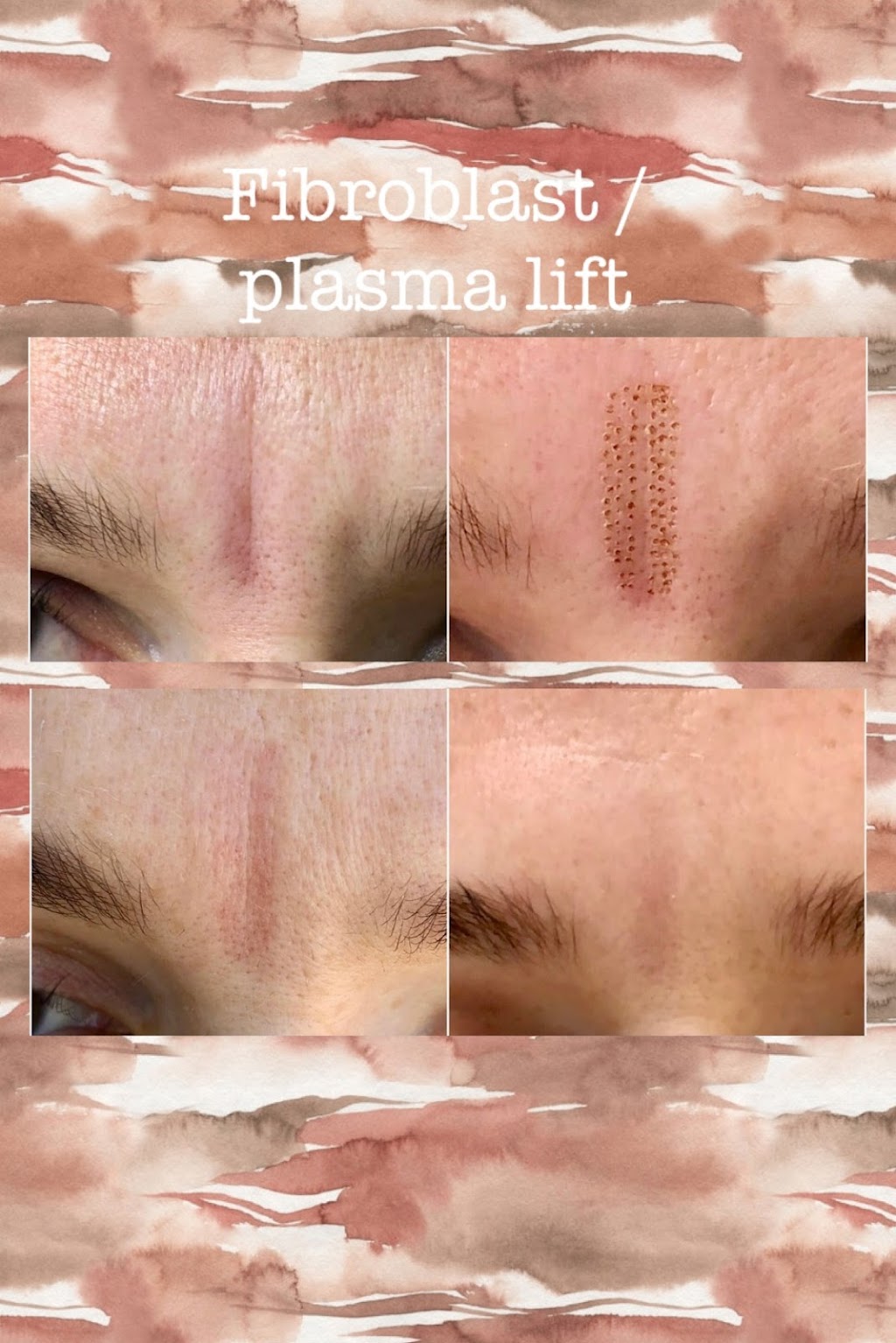 Skin by Marissa Advanced Aesthetics | 1120 11th St, St Cloud, FL 34769, USA | Phone: (407) 494-3749