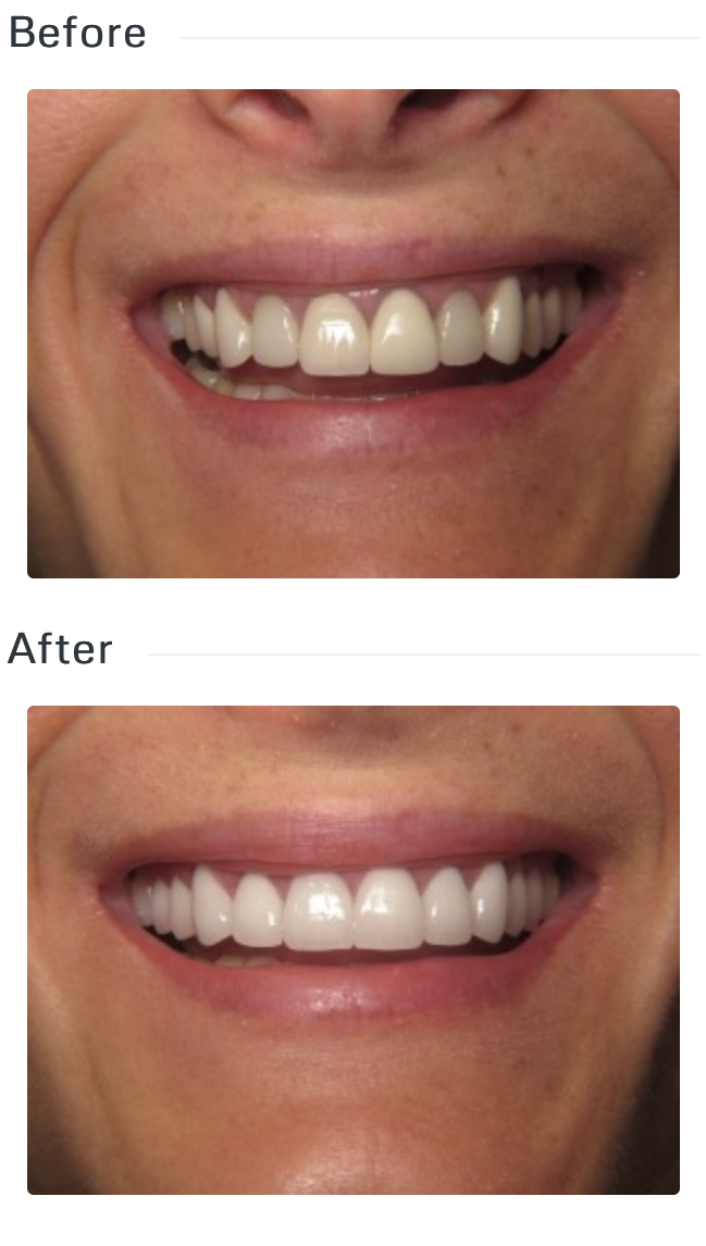 North Coast Dental Implants & Cosmetics | 365 S Rancho Santa Fe Rd STE 105, San Marcos, CA 92078 | Phone: (760) 736-9200