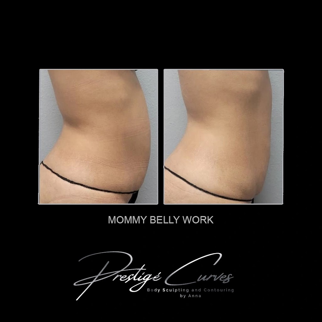 Prestigé Curves Body Sculpting | 520 W Lacey Blvd #3, Hanford, CA 93230, USA | Phone: (559) 904-9943