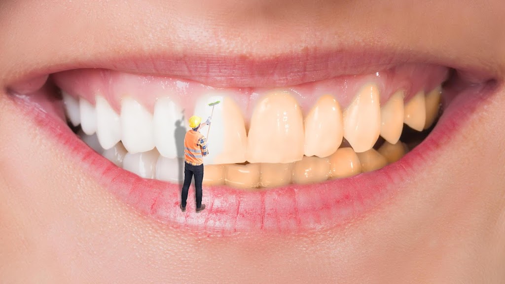 White Smiles Of Denton | 303 N Carroll Blvd, Denton, TX 76201, USA | Phone: (940) 594-3789