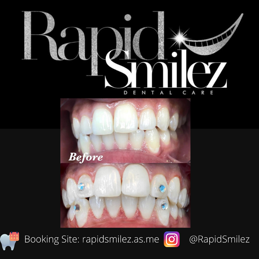 Rapid Smilez | 5611 W Fayetteville Rd #101, Atlanta, GA 30349, USA | Phone: (866) 438-8837