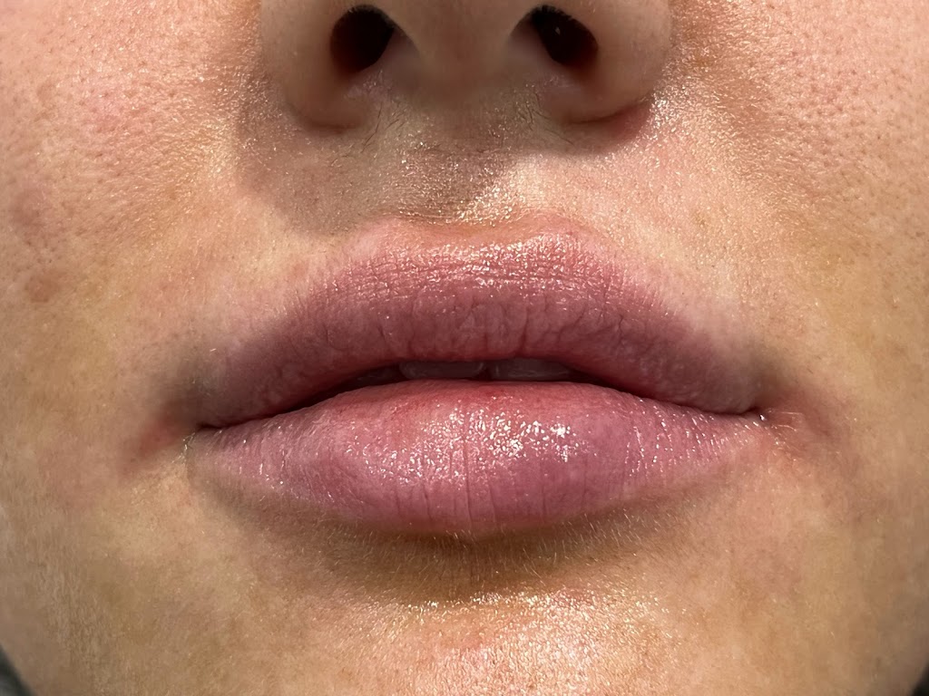 1Aesthetic | 1200 Ave at Port Imperial, Weehawken Township, NJ 07086, USA | Phone: (201) 313-8899