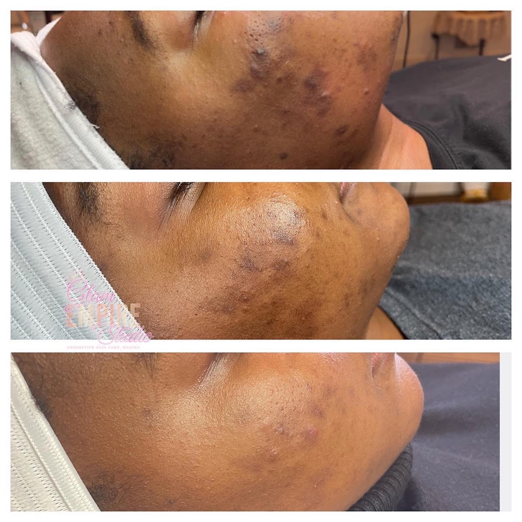 Glam Empire Studio LLC- Corrective Skin Care & Waxing | 213 Old Padonia Rd #2, Cockeysville, MD 21030, USA | Phone: (443) 826-0846