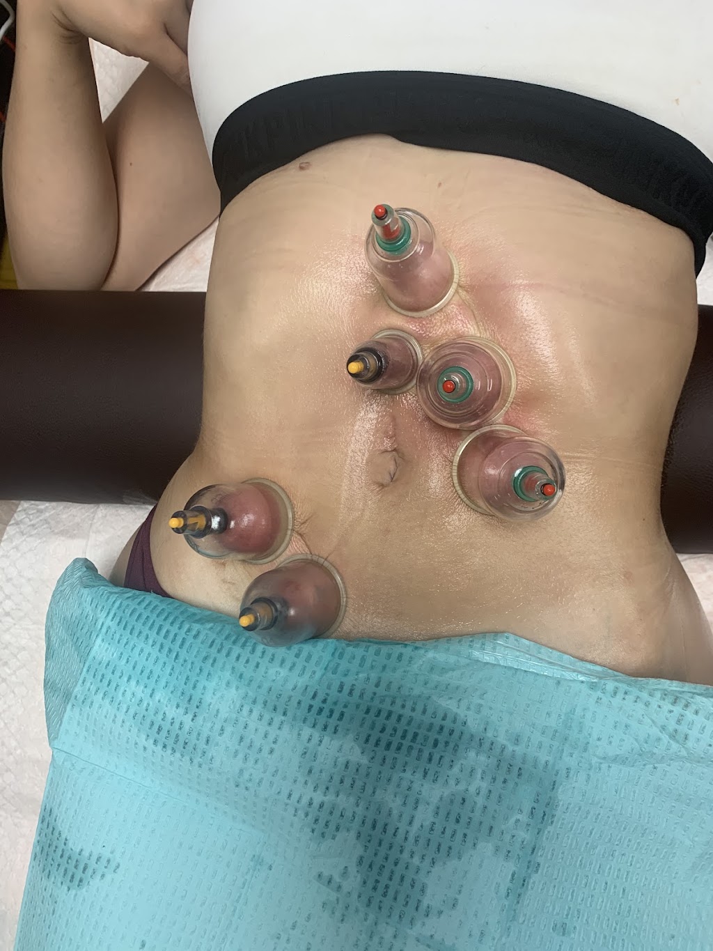 Beauty and Body | 1115 Via Verde, San Dimas, CA 91773, USA | Phone: (626) 838-6908