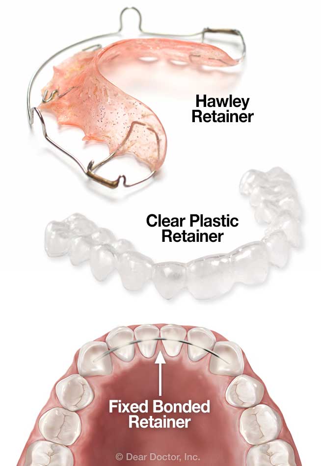 Hagler Orthodontics | 1290 N Monroe Dr, Xenia, OH 45385, USA | Phone: (937) 372-9279