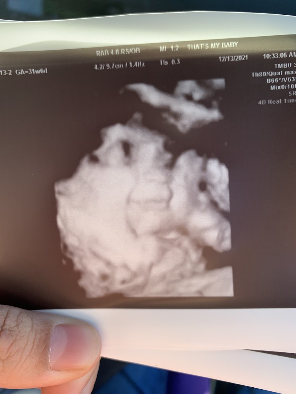 Thats My Baby Ultrasound | 3022 Mitchellville Rd Suite 202, Bowie, MD 20716, USA | Phone: (301) 249-2635