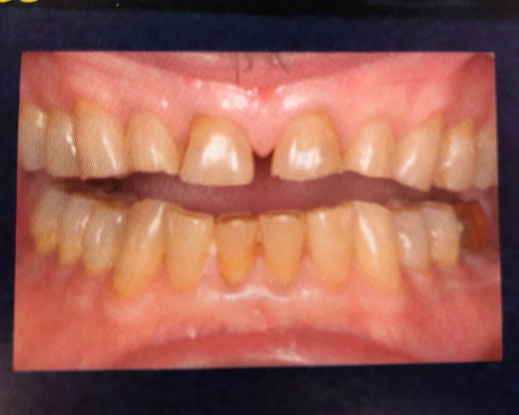 Nice Dental, Shiyu Wang, DDS, San Leandro | 299 Juana Ave # A, San Leandro, CA 94577, USA | Phone: (510) 969-7686