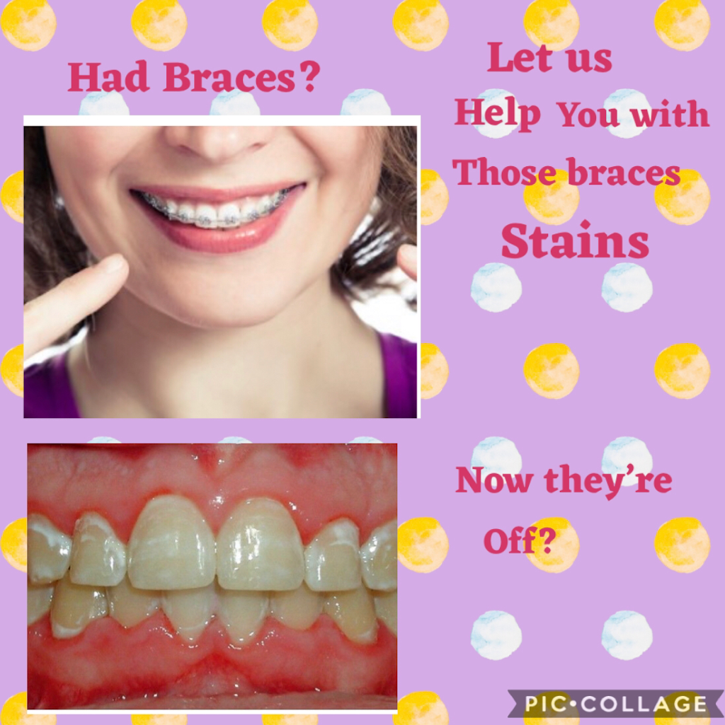Smile Labs of Houma LLC | 112 Equity Blvd #102, Houma, LA 70360, USA | Phone: (985) 232-7793