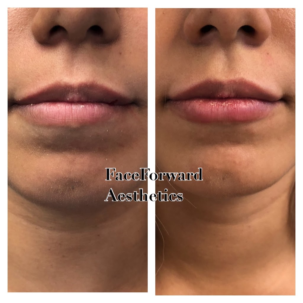 Dermaden Aesthetics | 4955 S Alma School Rd #10, Chandler, AZ 85248, USA | Phone: (480) 340-5106