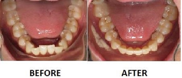 ProSmile Dentistry: Parisa Zarbafian DDS | 26720 Towne Centre Dr A, Foothill Ranch, CA 92610, USA | Phone: (949) 583-1500
