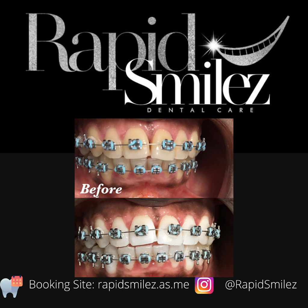 Rapid Smilez | 5611 W Fayetteville Rd #101, Atlanta, GA 30349, USA | Phone: (866) 438-8837