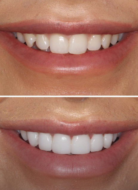 Smiles By Design | 2165 Fourth St B, Livermore, CA 94550, USA | Phone: (925) 443-4182