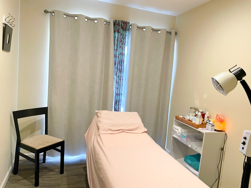 AcuBay Clinic Morgan Hill | Pediatric & Adult Acupuncture | 15585 Monterey St # E, Morgan Hill, CA 95037, USA | Phone: (408) 828-3409