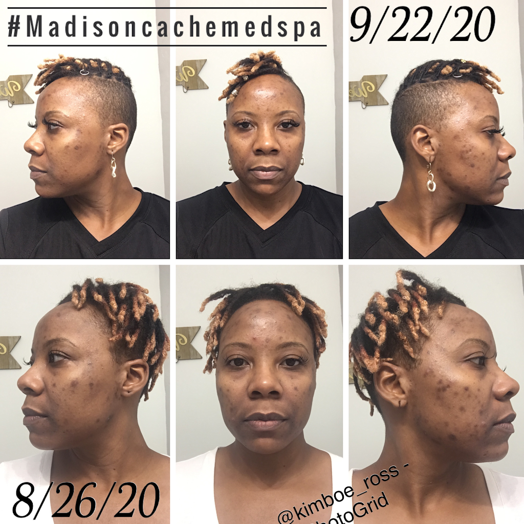 Madison Caché Medspa | 428 W Davis St #2, Dallas, TX 75208 | Phone: (469) 396-8514