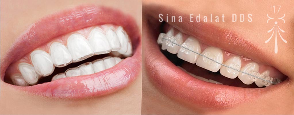 Sina Edalat, DDS | 5906 Monterey Rd, Los Angeles, CA 90042 | Phone: (323) 256-2680