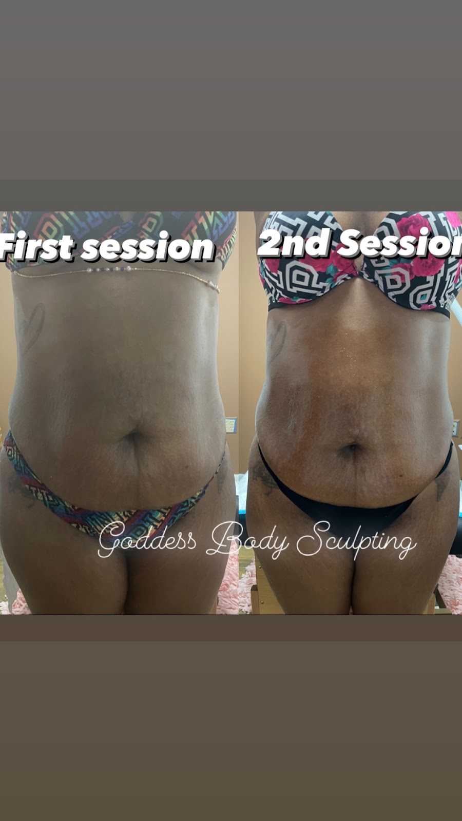 Goddess Body Sculpting Spa & Wellness Center | 840 SW 81st Ave Suite Q303, North Lauderdale, FL 33068, USA | Phone: (954) 707-0291