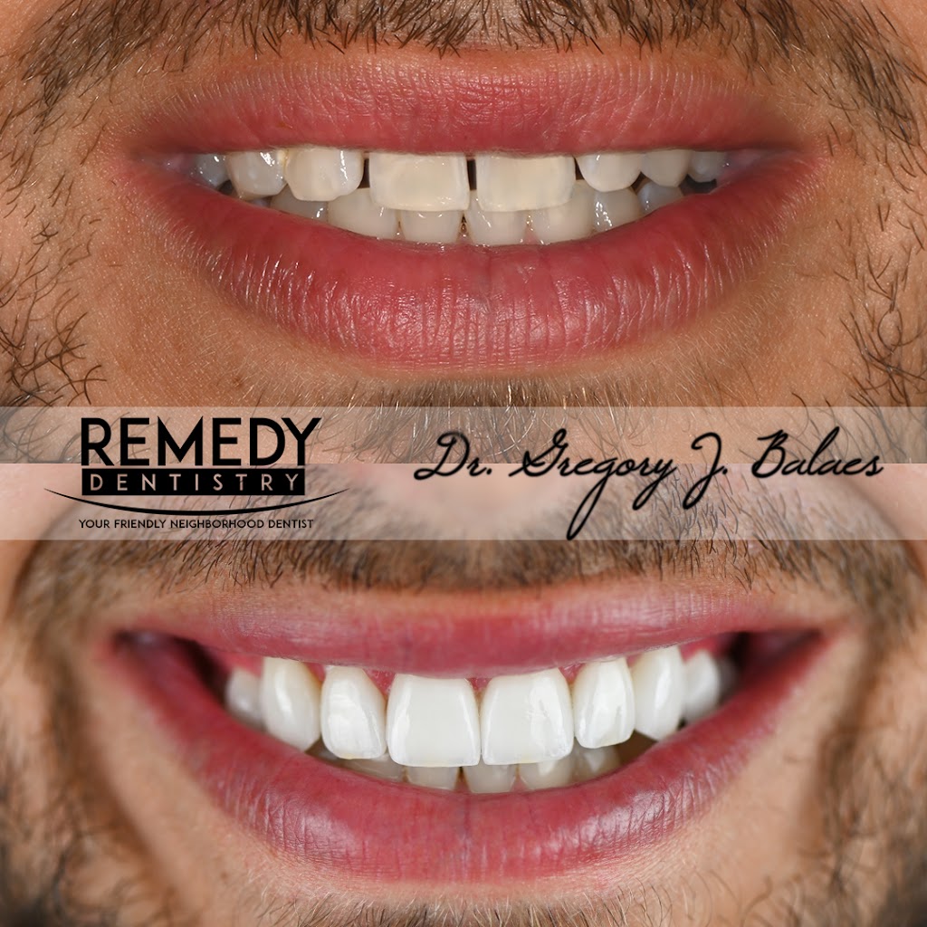 Dr. Gregory J. Balaes - Cosmetic Dentist | 932 Woodrow Rd, Staten Island, NY 10312, USA | Phone: (718) 747-8711