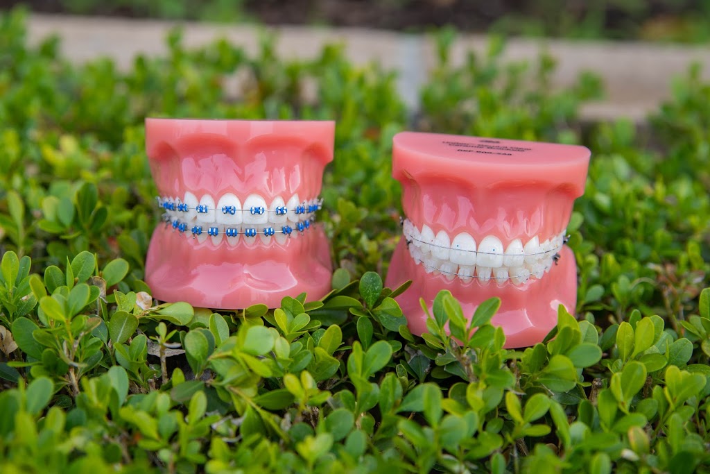 Orthodontics of Carson | 101 W Carson St Suite B, Carson, CA 90745, USA | Phone: (310) 626-0261