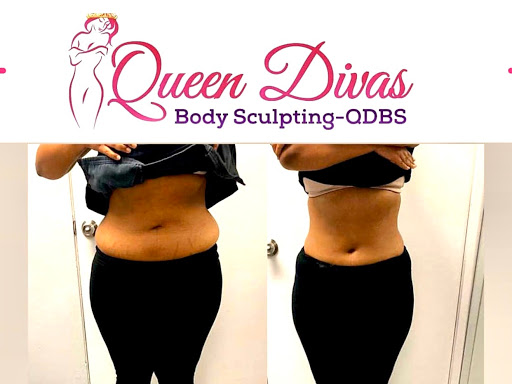 Queen Divas Body Sculpting Inc | 1040 Hempstead Turnpike # LL1, Franklin Square, NY 11010, USA | Phone: (347) 433-5580