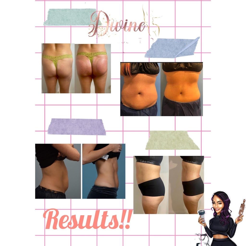 Divine Bodysculpting by Lisa Marie | 2445 Russell St, Crandall, TX 75114, USA | Phone: (469) 988-4115