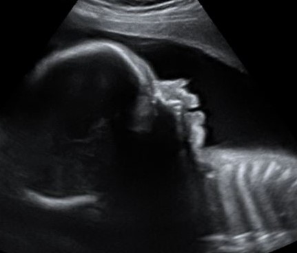 Anticipation Ultrasound Studio | 5321 S Sheridan Rd #34, Tulsa, OK 74145, USA | Phone: (918) 665-2229