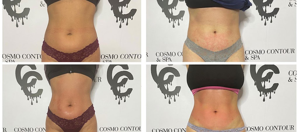 Cosmo Contour & Spa | 7129-7131 Owensmouth Ave Suite 2, Canoga Park, CA 91303, USA | Phone: (818) 330-5220