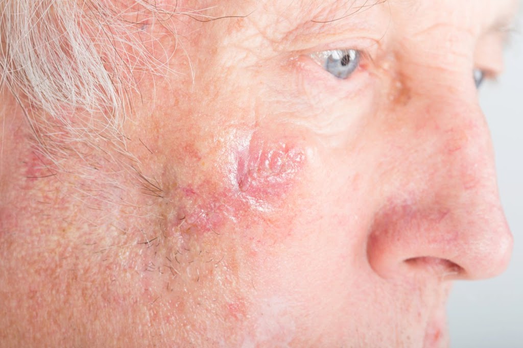 English Dermatology San Tan Valley | 36359 N Gantzel Rd #103, San Tan Valley, AZ 85140, USA | Phone: (480) 428-2602