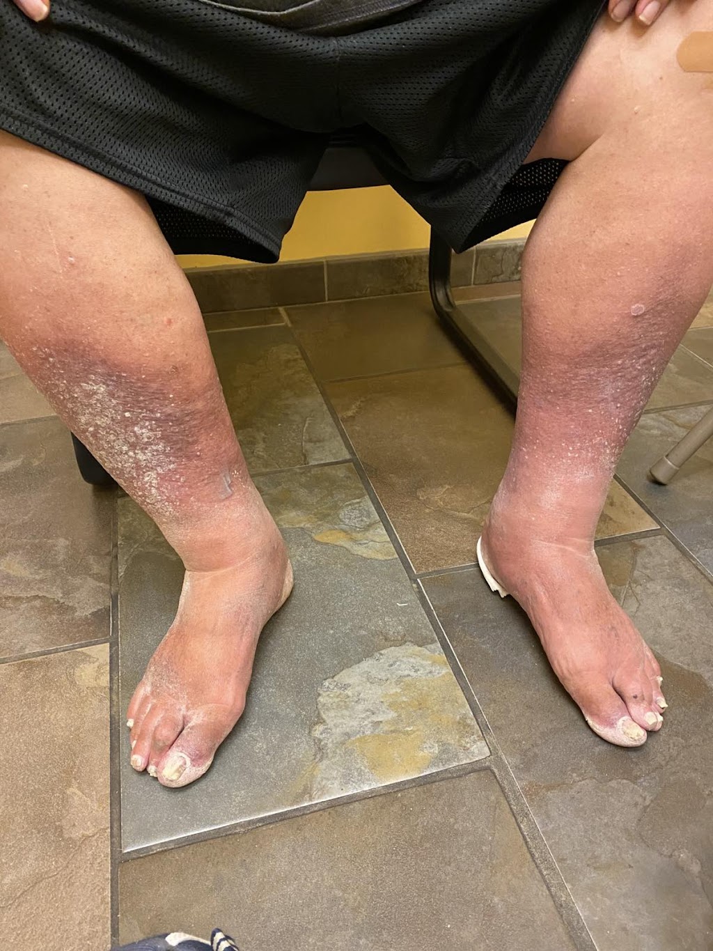 Richard P. Jacoby, DPM Foot & Ankle Surgeon | 1968 N Peart Rd Suite 102, Casa Grande, AZ 85122, USA | Phone: (480) 717-5011