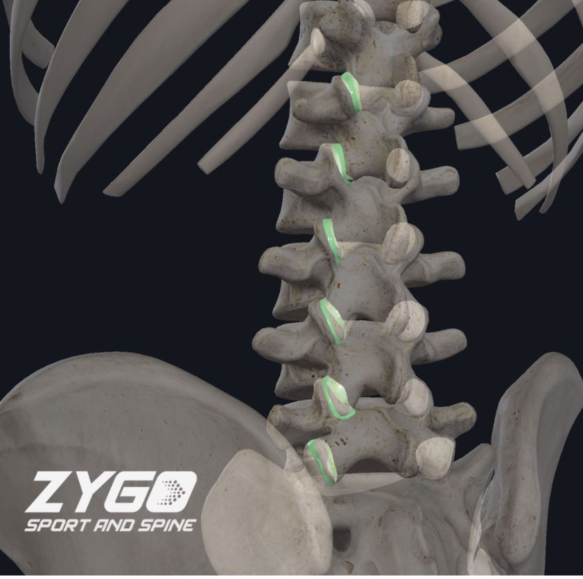 Zygo Sport and Spine | 10824 E Crystal Falls Pkwy #302C, Leander, TX 78641, USA | Phone: (512) 270-8351