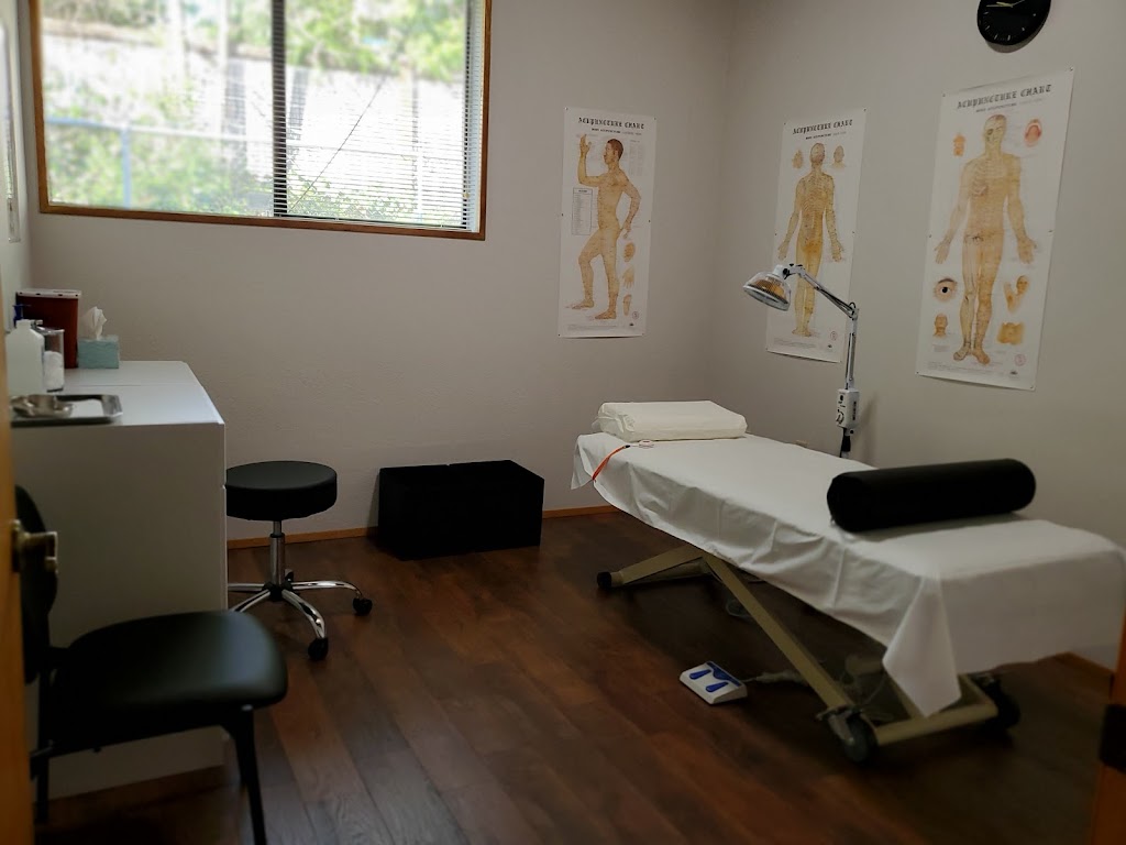 Federal Way Acupuncture Center | 202 S 348th St Ste 4, Federal Way, WA 98003, USA | Phone: (253) 517-5709