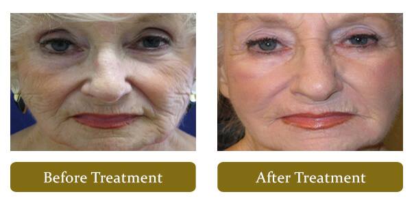 Foothill Cosmetic Surgery Center | 2301 E Foothill Blvd #200, Glendora, CA 91740, USA | Phone: (855) 630-5533
