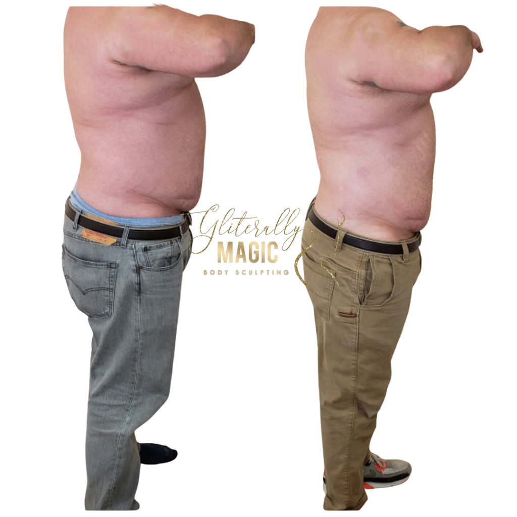 Gliterally Magic Body Sculpting | 3600 Clayton Rd c1, Concord, CA 94521 | Phone: (925) 687-7788