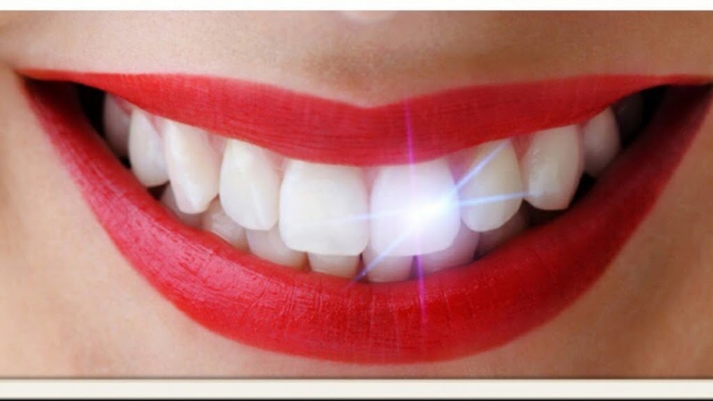 Teeth Whitening by Da Vinci | 2655 W Guadalupe Rd #8, Mesa, AZ 85202, USA | Phone: (480) 807-0002
