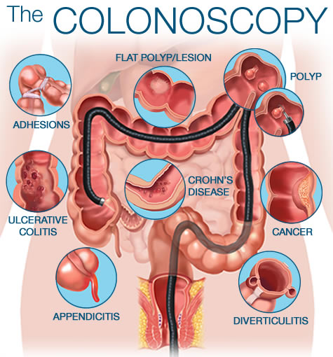 Shahzad MD Gastroenterology | 310 Kingwood Executive Dr, Kingwood, TX 77339 | Phone: (281) 893-4488