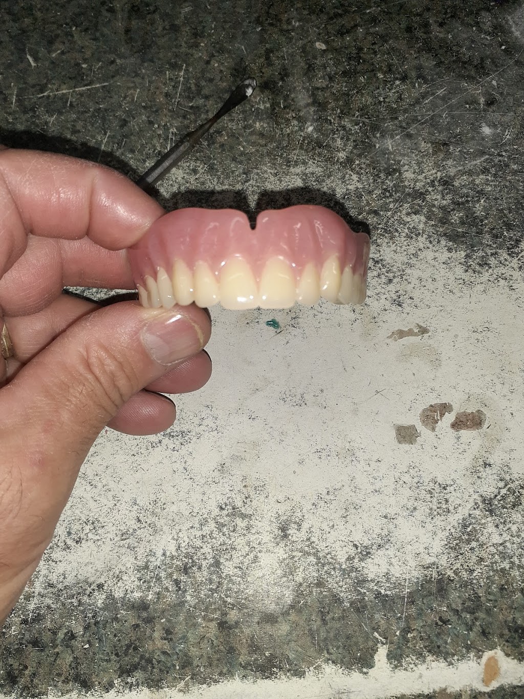 R&B Dental Lab | 21374 Ramona Ave, Apple Valley, CA 92307, USA | Phone: (760) 261-2425