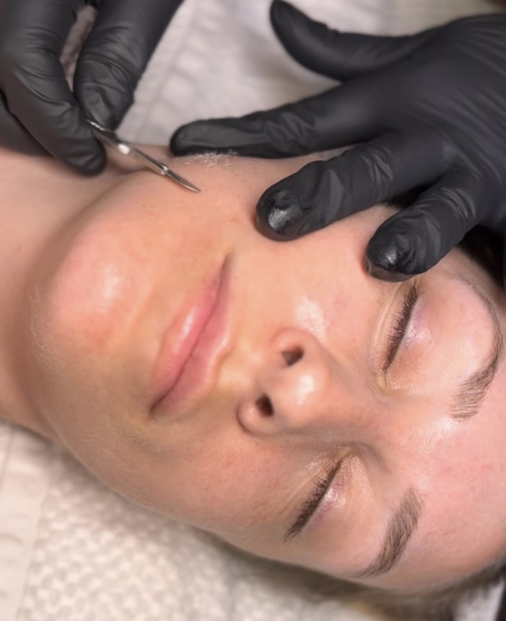 About Face Esthetics LLC | 517 E Main St, Middletown, NY 10940, USA | Phone: (845) 956-0064