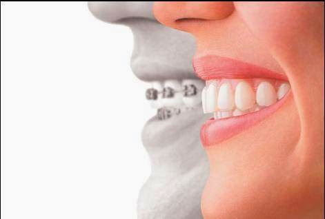 Dr. Craig L Menker, DMD Orthodontist | 58 Mt Bethel Rd #201, Warren, NJ 07059, USA | Phone: (908) 756-6006