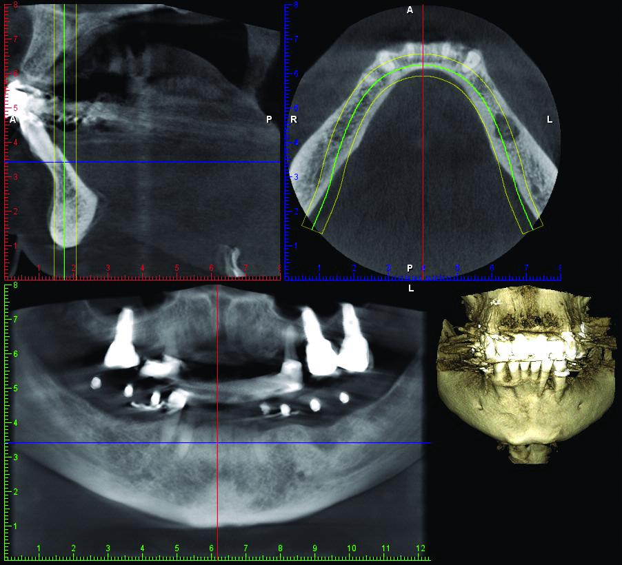 Elite Smiles | 24155 Magic Mountain Pkwy, Valencia, CA 91355, USA | Phone: (661) 222-7724