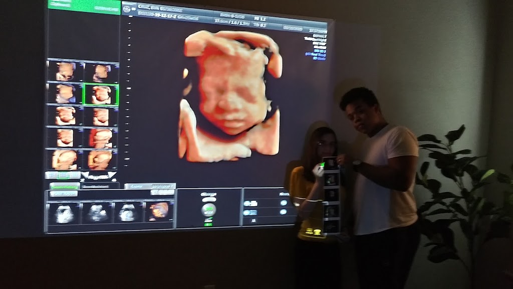 Life Imaging 3d 4d HD Ultrasound Studio | 471 Mariner Blvd, Spring Hill, FL 34609, USA | Phone: (352) 573-5141