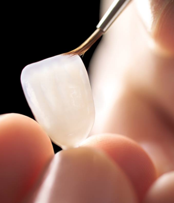 MicroDental Las Vegas Laboratory | 1401 Hillshire Dr # 110, Las Vegas, NV 89134, USA | Phone: (702) 458-1079