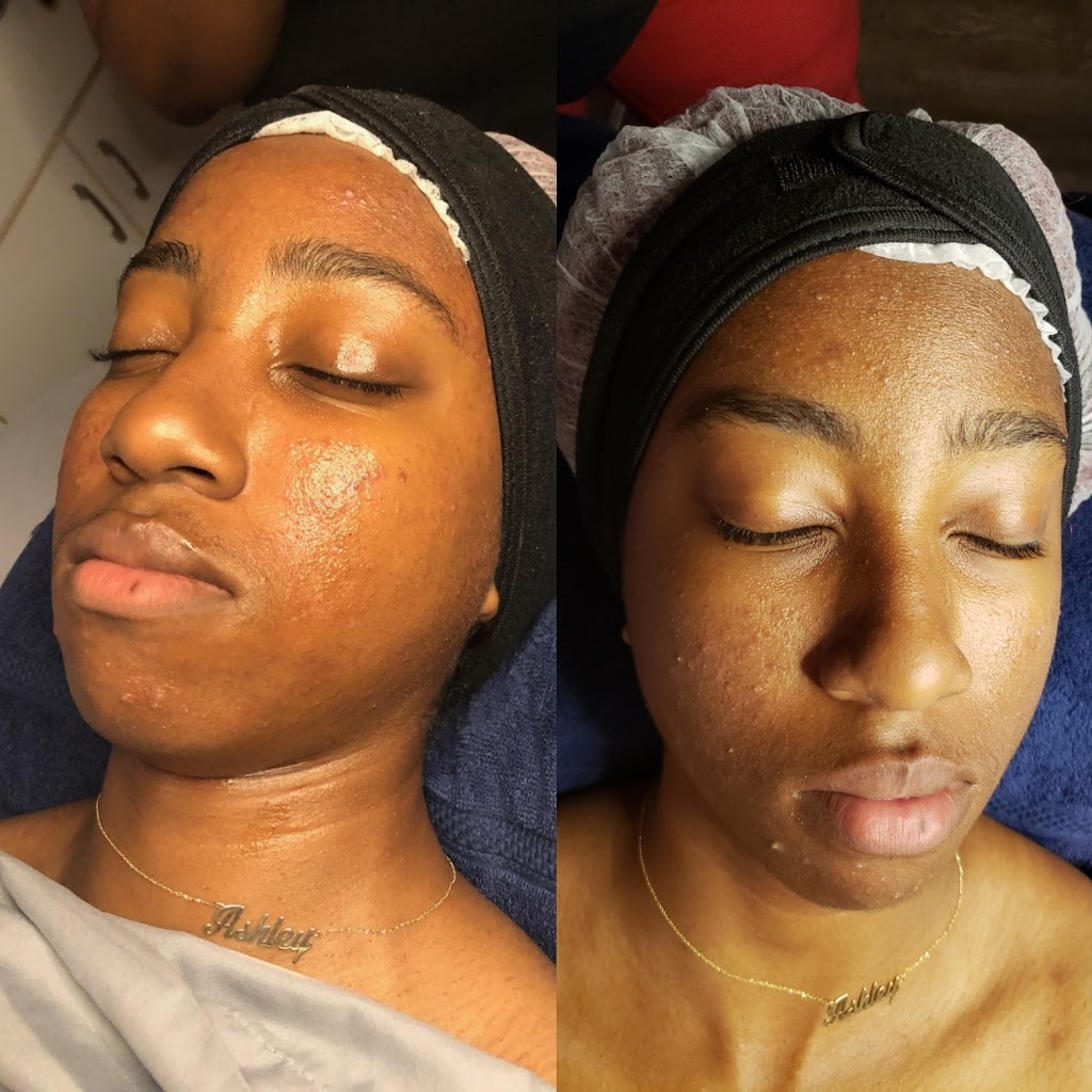 Faced by Jes Skin and Beauty Studio | 10001 Derekwood Ln #215-205, Lanham, MD 20706, USA | Phone: (202) 656-8804