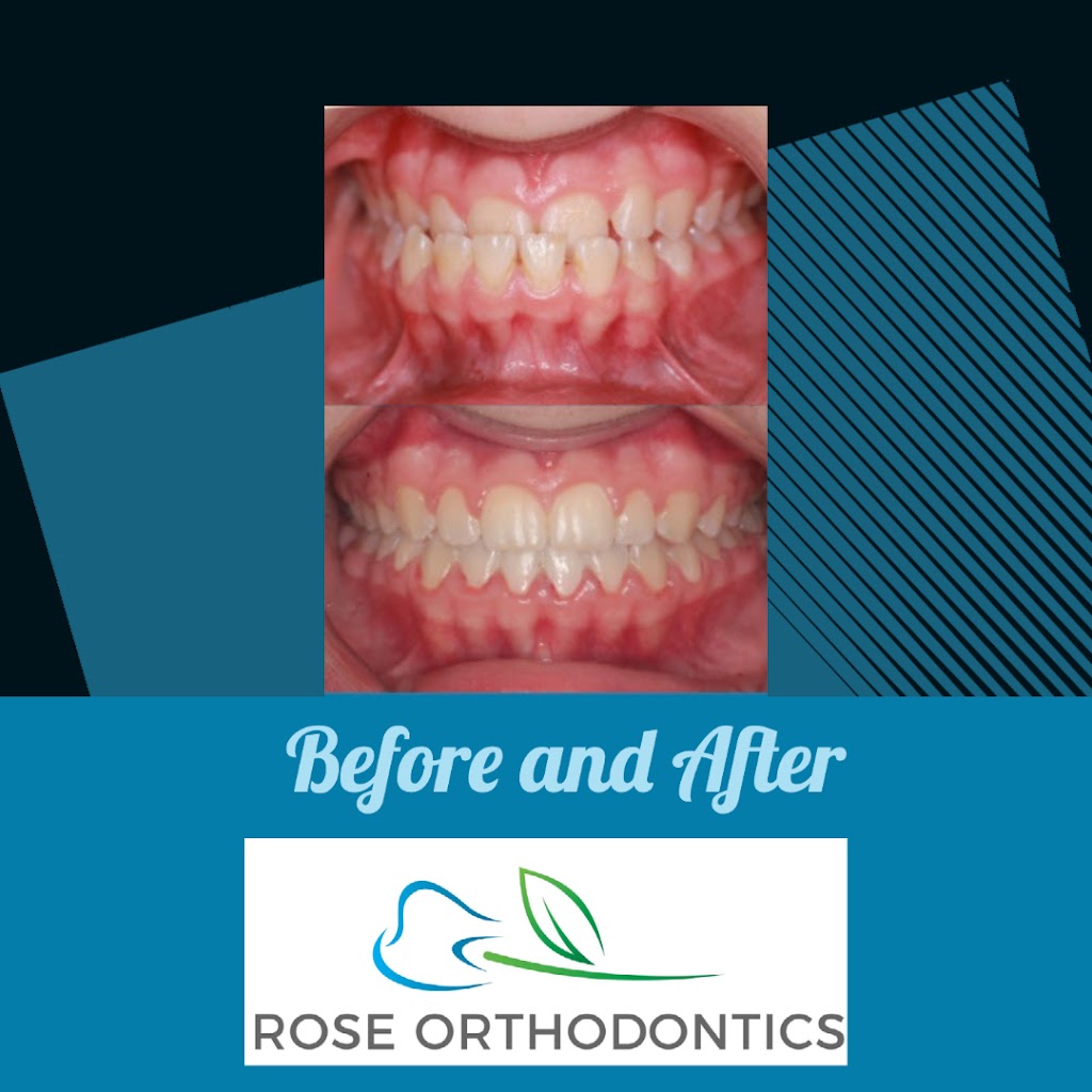 Rose Orthodontics: Aaron Rose, DMD, MS | 980 W Central Ave Suite D, Delaware, OH 43015 | Phone: (740) 272-4455